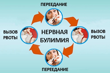 Лечение булимии в Чертково